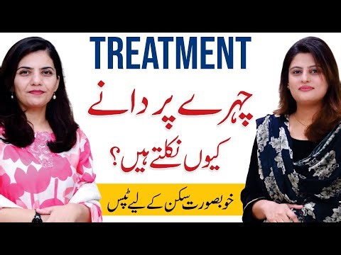 Why Pimples Appear & How to Stop Them | Dr. Zahra Shehzad