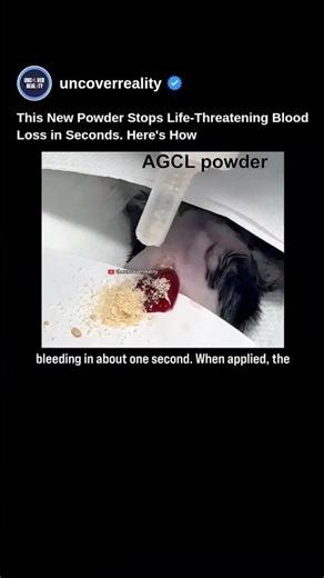 This Medical Powder Spray Could Save Thousands of Lives In Just One Second #medical #tech #shorts