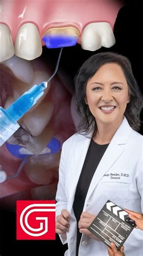 5 Steps to ZIRCONIA Crown Cementation #dentalcrowns
