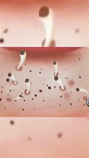 Satisfying Pimple Popping ASMR 😌 | Relaxing Skincare Animation