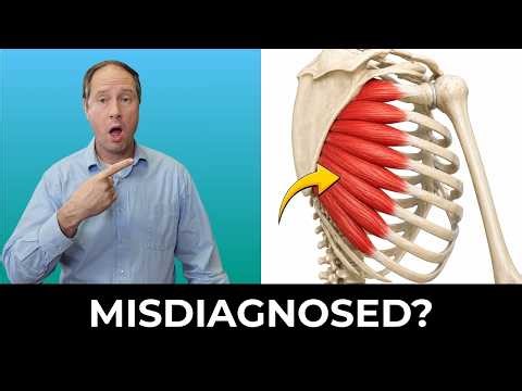 The HIDDEN Shoulder Blade Weakness Behind Neck Pain, Cervicogenic Dizziness & Headaches: 4 FIXES
