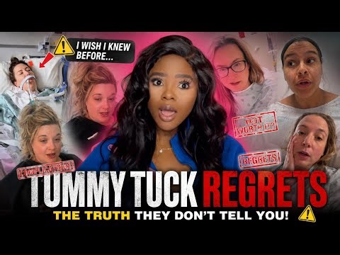 “Before You Get a Tummy Tuck… WATCH THIS”