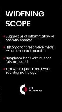 When a “Simple” Lingual Tori Isn’t Simple: CBCT Insights Every Dentist Should Know