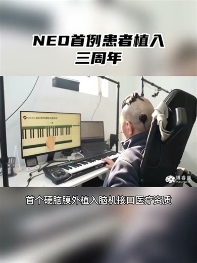 It's been three years since the first patient received the Neuracle NEO implant