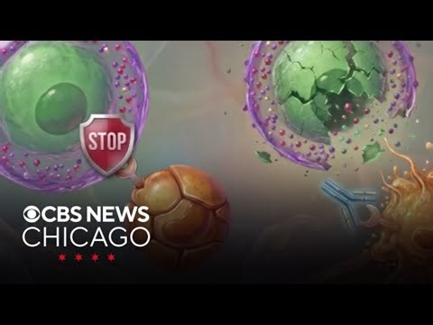 Northwestern Medicine trialing new antibody therapy in fight against pancreatic cancer