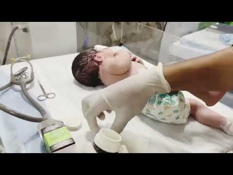 Discomfort to relief 😔| Glycerin Suppository Administration in a Baby | Safe & Gentle Pediatric Care