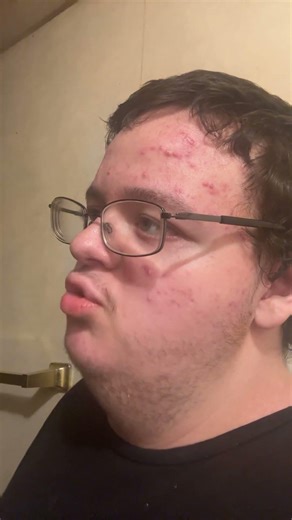 code X makes no sense