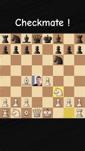 Best chess opening in world #chess