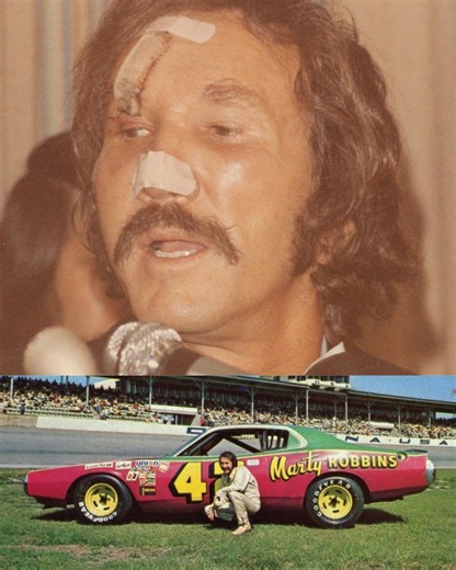 He left the scene with broken ribs, a damaged tailbone, and required 32 stitches. - Music Legend