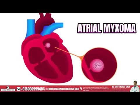 Robotic Heart Surgery: Precision, Safety & Faster Recovery ❤️‍🩺🤖