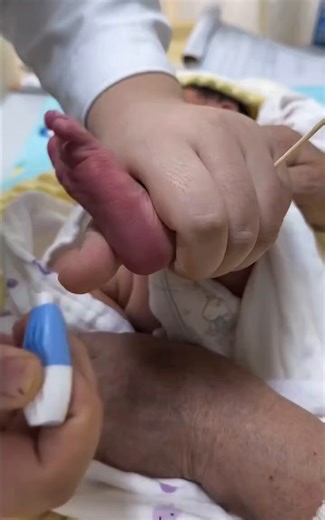 RT @indigoati: I didn’t know this is how they take the babies blood😭😭😭😢