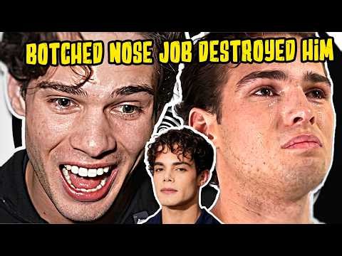CLAVICULAR'S LIFE IS FALLING APART👃| RELAPSED, MOGGED, REJECTED ☠️
