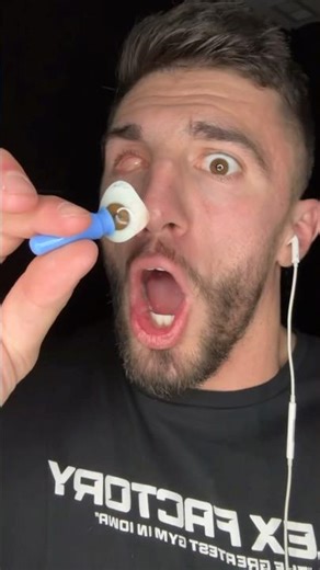 MY EYEBALL FELL OUT 😳