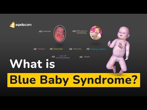 What is Blue Baby Syndrome? | Physiology