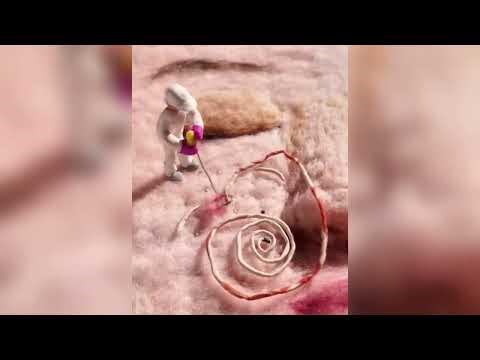 Pimple Popping - Ultimate Pimple Popping Compilation#113