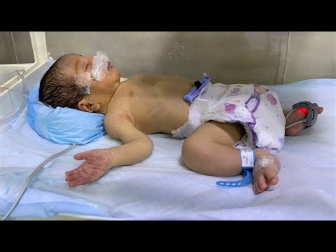 NICU Baby Recovery – Real Stories, Physio, & Shocking Transformations