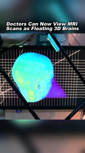 Slice-AR Turns MRI Scans into Floating 3D Brains