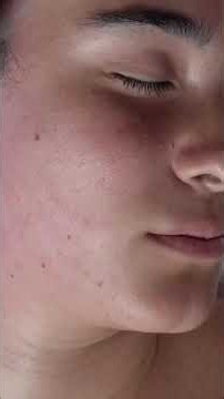 Satisfying Facial Hair Removal ASMR: Watch This Transformation! #shorts