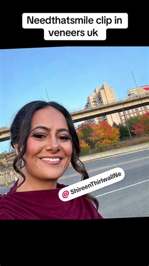 shireen.d.thirlwall I got my veneers in June for my 40th birthday!! I’ve smiled every day since! I’ve had so many compliments and not afraid to say they are clip ins!! I’m absolutely petrified of the dentist so couldn’t go to turkey for turkey teeth but need that smile have made me smile again ❤️ Shop now www.needthatsmile.co.uk MISSING TEETH WE CAN HELP ?😄 • STANDARD TOP & BOTTOM NOW ONLY £199 • SUPER THINS TOP AND BOTTOM NOW ONLY £300 • SHOP NOW www.needthatsmile.co.uk ❌IF YOU HAVE ANY QUERIE