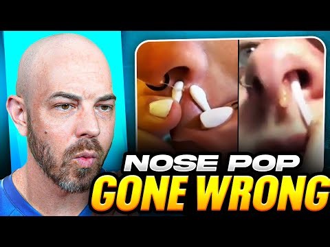 These TikTok Pimple Popping Videos Made Me Question Everything (Doctor's Honest Reaction)