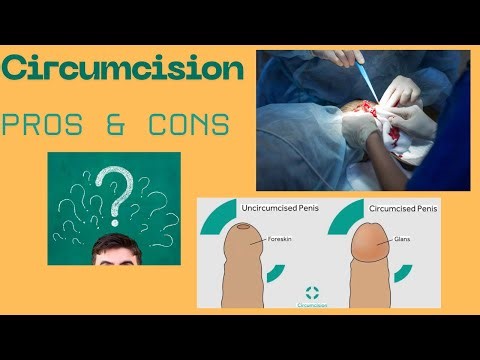 Circumcision: Pros and Cons Explained by a Urologist (Myths vs Facts)
