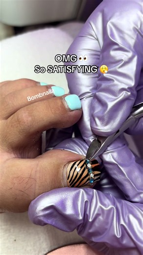 Ingrown Toenail Cleanup Satisfying Pedicure Process