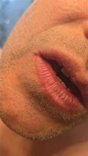 Dound a Piece of broken metal stuck in my lip. Using a neodymium magnet to pull it out. #diy #tool