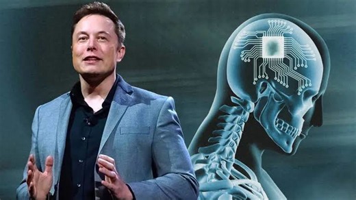 Elon Musk's brain chip is getting smarter - how 50,000 hours of human testing could change the future of Neuralink