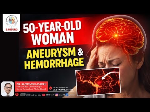 Catheter-Based Treatment of Ruptured ICA Aneurysm | Subarachnoid Hemorrhage Case