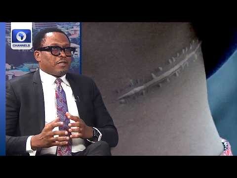 Abuja Kidney Harvesting Scandal: What Does the Law Really Say? | Dateline Abuja