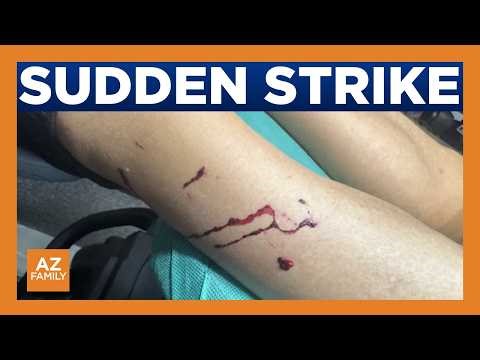 Scottsdale grandfather survives rattlesnake bite, raises awareness