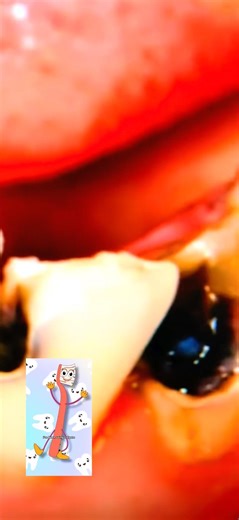 Kids actually want to go to the dentist and brush their teeth after this #hygiene #shorts #parenting