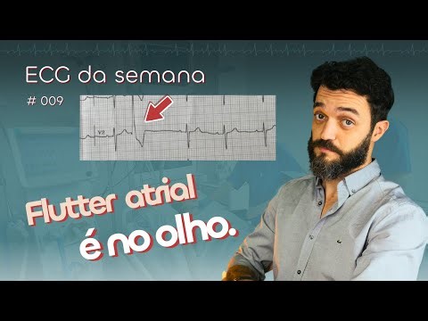 ECG da semana 009: Flutter atrial.