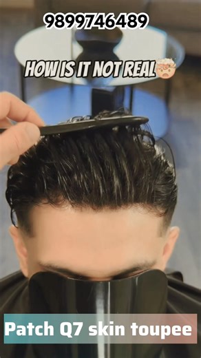 Q7 Skin Base hair patch: World’s most natural look toupee #hairpatch #shorts #viral #wigs #ytshorts