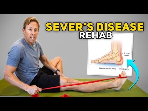 Sever’s Disease in Kids: Why Heel Pain Happens and How Rehab Helps