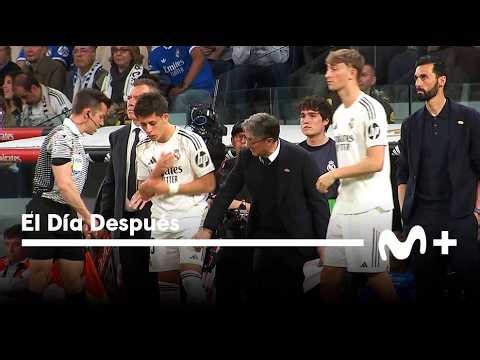 El Día Después (13/04/2026): Lo que el ojo no ve