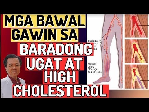 Mga Bawal Gawin sa Baradong Ugat at High Cholesterol - By Doc Willie Ong