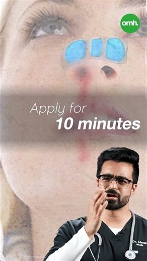 नाक से खून आना? Emergency में घर पर क्या करें—डॉक्टर ने बताया | SOS Steps for Nosebleed