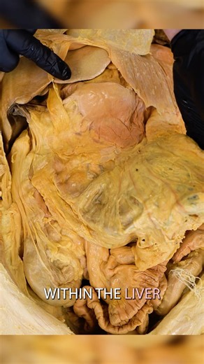 The Fat We Want to Lose