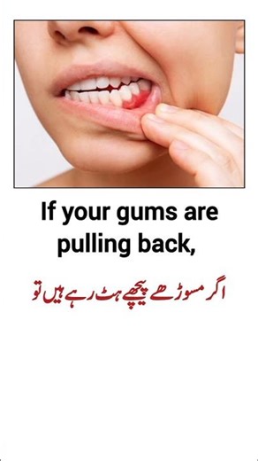 How To Stop Gums Receding Fast #dentalcare