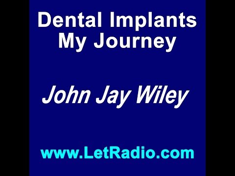 Dental Implants - The Decision To Move Forward