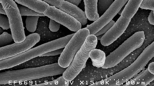 Here’s what you need to know about E. coli