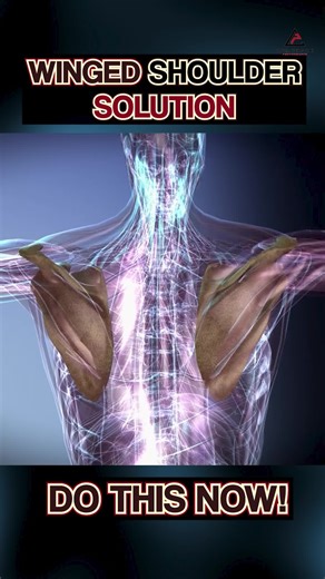 ❌ You’ve stretched, rolled, and mobilized… but your scap still wings. Scapular winging isn’t a tension problem. It’s a control problem. You don’t need more stretching — you need targeted scapular strength. 🔥 Why the Other Stuff Fails: 📉 Mobility Without Control = Instability 🧱 Posture Without Strength = Collapse under load 💥 Passive Fixes = Zero carryover to movement 🛠️ Strengthen What Actually Fixes It: 🎯 Banded Scap Angel – Build precision through scapular motion ⬆️ Wall Slide Lift Off –