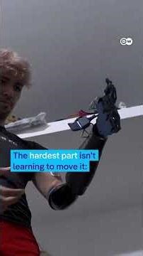 A childhood promise turned into a bionic arm