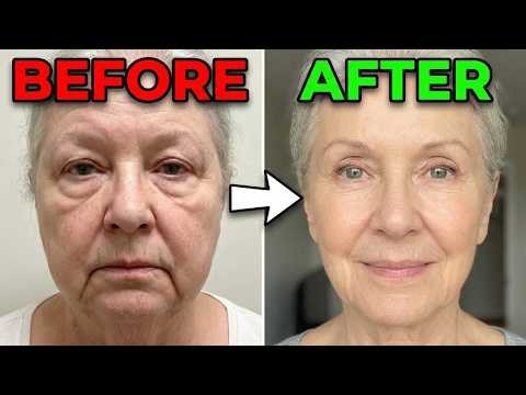 How to Fix a Puffy Face (The Real Cause Nobody Talks About)