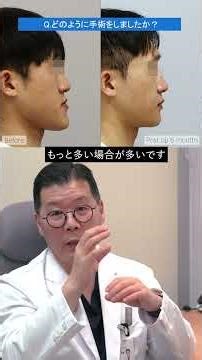 男性 受け口 両顎手術レビュー！"正直...少し大変です"