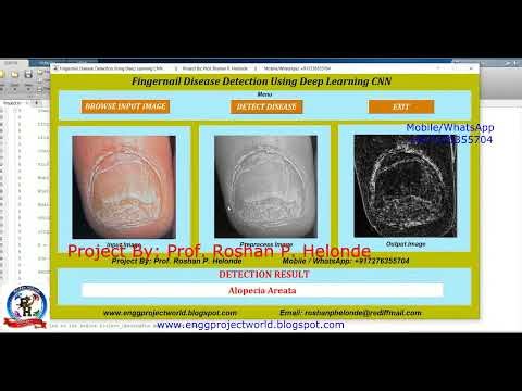 Fingernail Disease Detection Using Machine Learning Algorithm | Image Processing Matlab Project Code