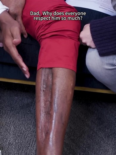 What Happened to Deion Sanders' Leg? NFL Injury Explained