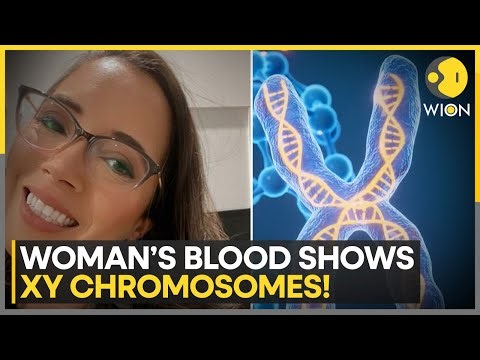 Doctors Shocked: Woman Found With Male XY Chromosomes in Blood Test | WION