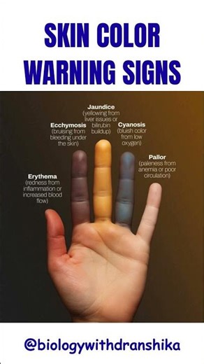 Skin Color Warning Signs You Should Never Ignore #skincolor #warningsigns #healthawareness